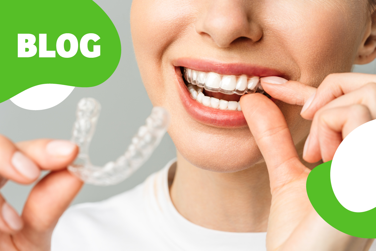 Invisalign: Ako funguje neviditeľný strojček na zuby?